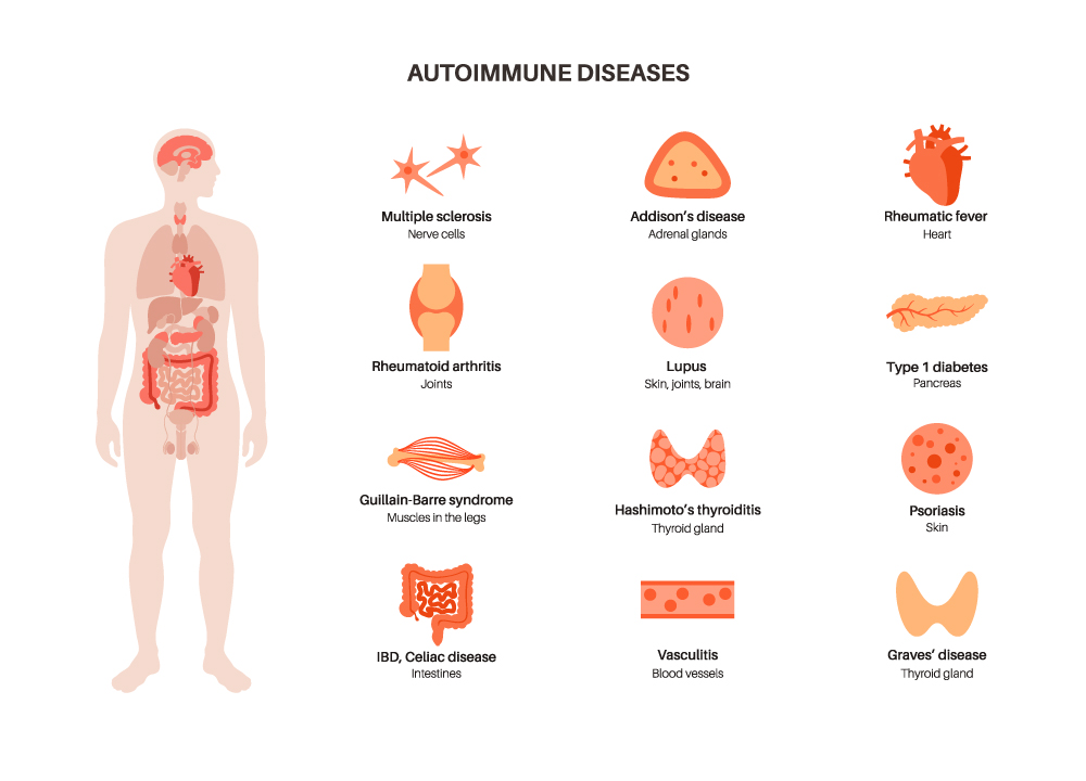 Functional Medicine for Autoimmune Diseases Las Vegas